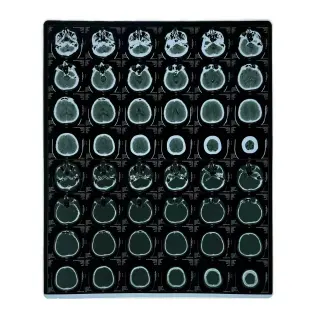 Radiology Dry Film