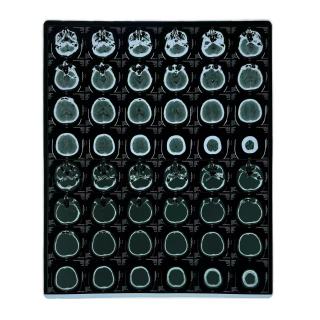 Radioloygraph Dry Film