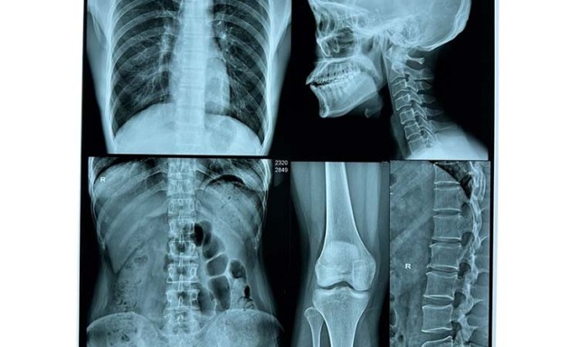 History of Medical Dry Image Film and future