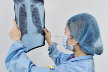 ایکس رے فلم ٹیکنالوجی میں نئی ​​پیشرفت: میڈیکل امیجنگ کی درستگی کو بڑھانا