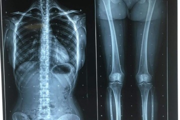Relatório de Análise sobre a Situação de Oferta e Demanda do Mercado de Filmes Médicos do Vietnã em 2025