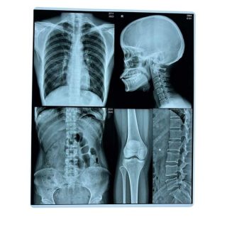 Filme térmico seco para uso médico