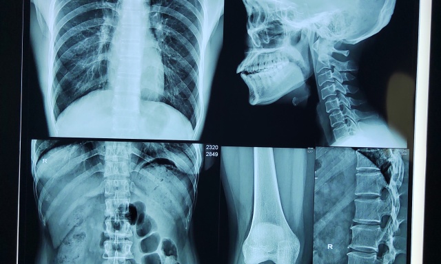 Advanced Medical Thermal Dry Film Revolutionizes Diagnostic Imaging: New Innovations Enhance Precision and Efficiency in Healthcare