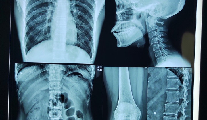 Advanced Medical Thermal Dry Film Revolutionizes Diagnostic Imaging: New Innovations Enhance Precision and Efficiency in Healthcare
