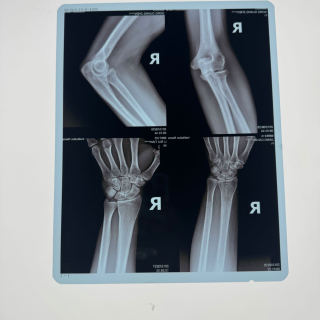 فيلم أزرق للطابعات الطبية النافثة للحبر