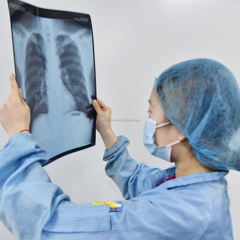 Filme térmico seco para imagens médicas