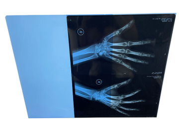 Medical Inkjet Film Revolutionizes Healthcare Imaging: Enhanced Precision, Cost-Efficiency and Sustainability Drive Global Adoption