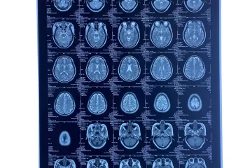 High-Quality Dry Medical Film Set to Debut at CMEF Shanghai 2026