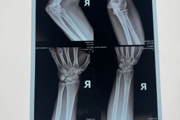 Medical Thermal Film Leads the Transformation of Medical Imaging: High Efficiency, Environmental Protection and Precision Drive Global Market Growth