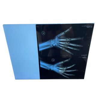 Policy: Hospitals Issue New Thermal Film Procurement Bids with Cloud Imaging Service Requirements