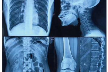 Las películas de rayos X médicas de alta calidad establecen nuevos estándares para el diagnóstico por imágenes médicas y la aplicación clínica.