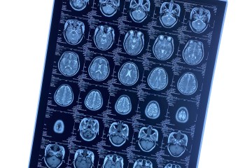 Uso de películas térmicas secas para imágenes en sistemas de imágenes médicas de TC, DR y RM.