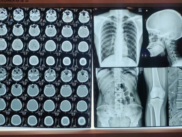 x-ray film