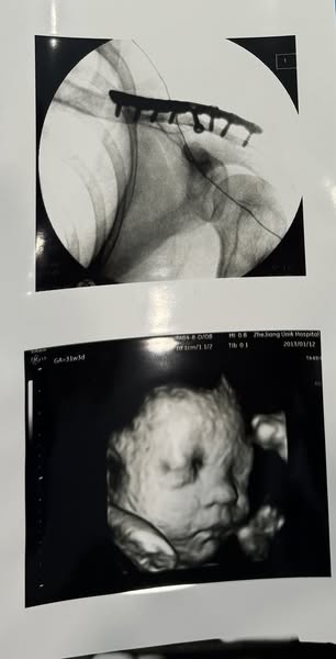 Ultrasound Paper