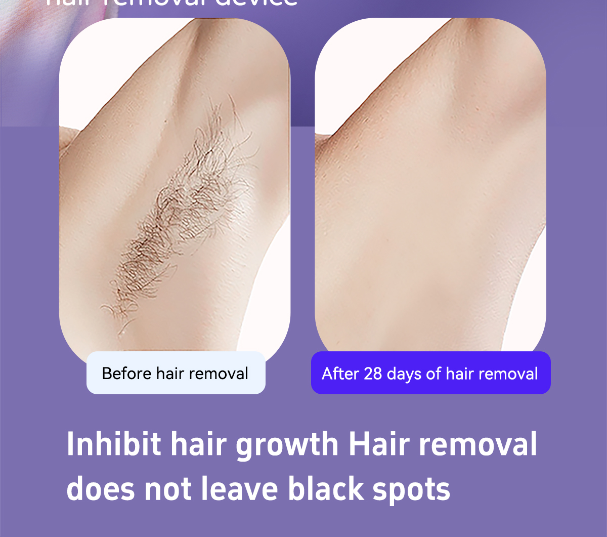 dual Lights Ipl Hair Removal Sapphire Dual Light dual Lights Ipl Hair Removal Sapphire Dual Light