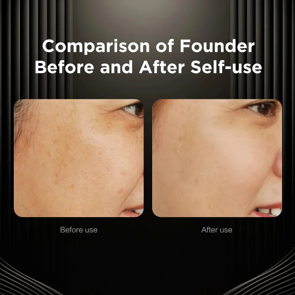 Microcurrent Facial Device Face and Neck Massager Lifting EMS Face Massager RF Device Beauty