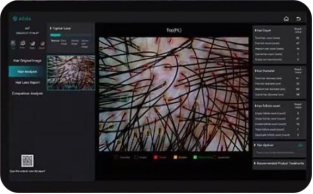 Comprehensive Analysis of Hair Follicle Testing