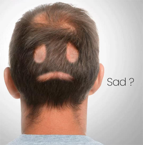 Innovative Hair Transplant Technology Innovative Hair Transplant Technology