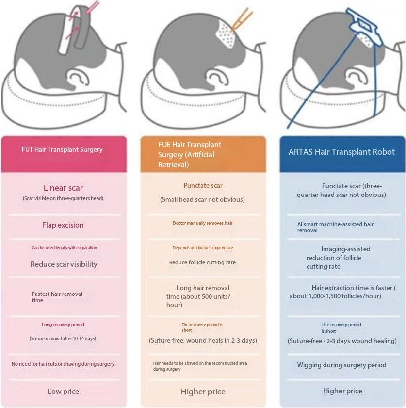 Hair Transplant Evolution