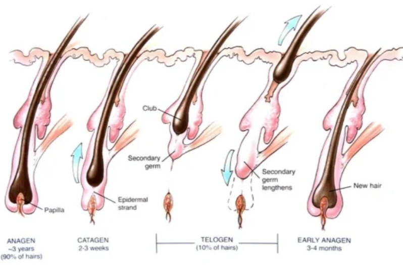 Hair Transplant Evolution