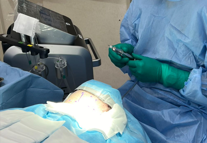 Technological Breakthroughs in Hair Transplant Devices