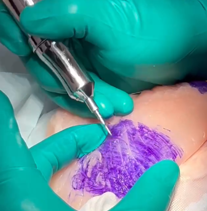 Hair Transplant Punch Handpiece