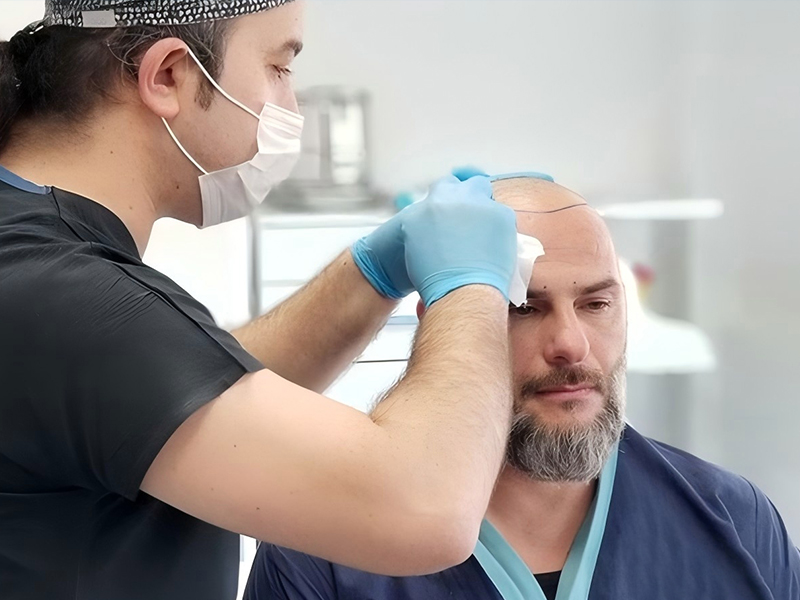 Testimonial from Dr. Mehmet Yılmaz, Istanbul Hair Clinic​