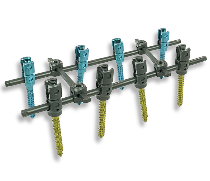 6.0 Spinal Pedicle Screw System