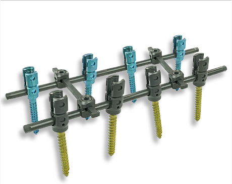 5.5 Spinal Pedicle Screw System