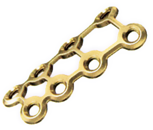 1.5mm Mini Locking Strut Plate