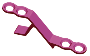 Laminoplasty Fixation System Cervical Spine Implant