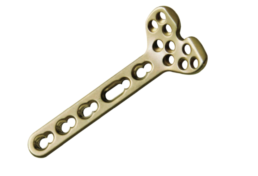 Distal Radius Locking Plate