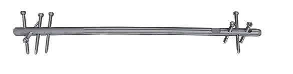 Retrograde Femoral Intramedullary Nail