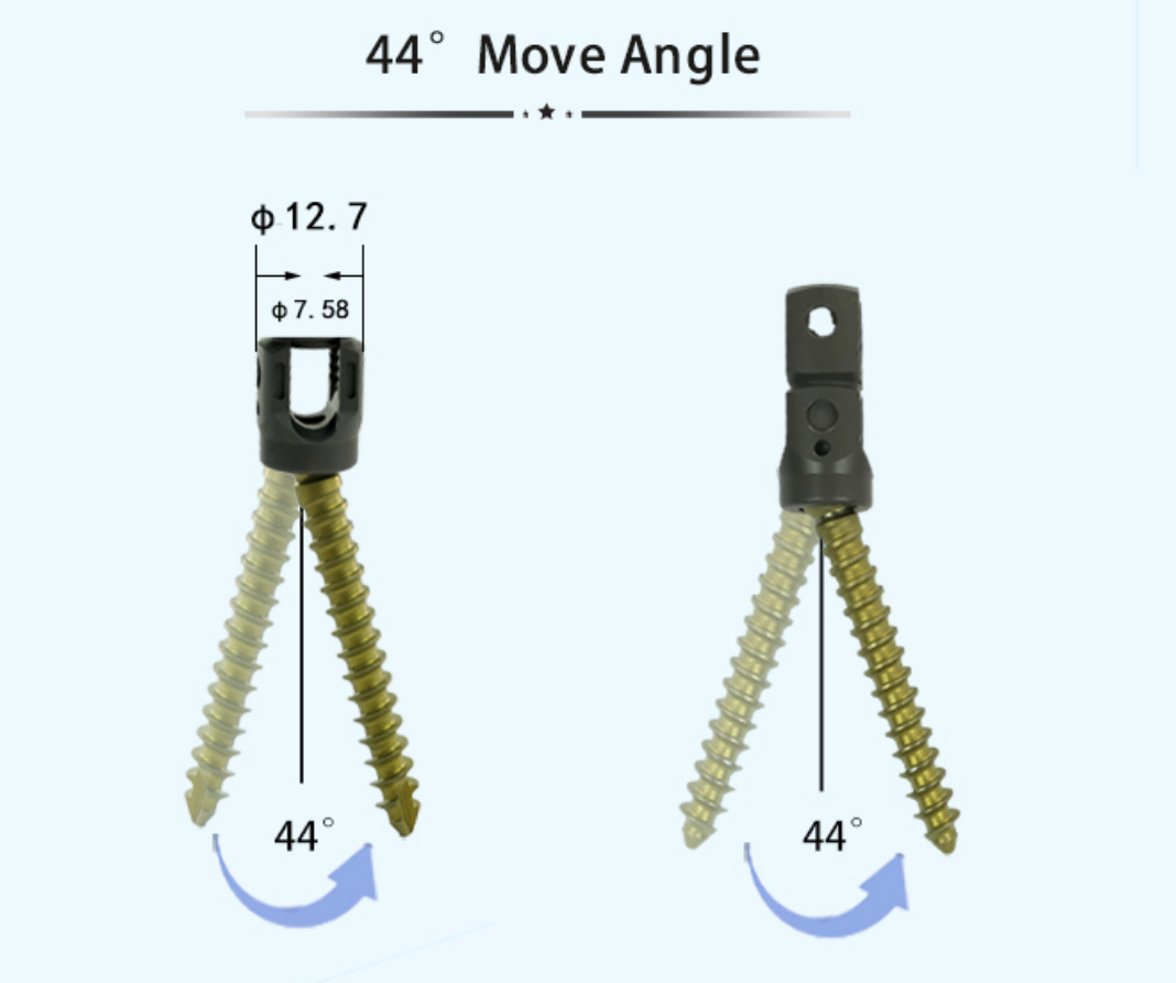 6.0 Spinal Pedicle Screw System 6.0 Spinal Pedicle Screw System