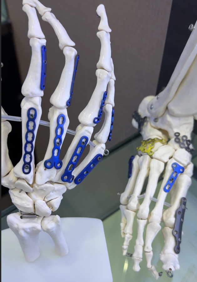 Three Modern Techniques for Upper Extremity and Pediatric Fractures