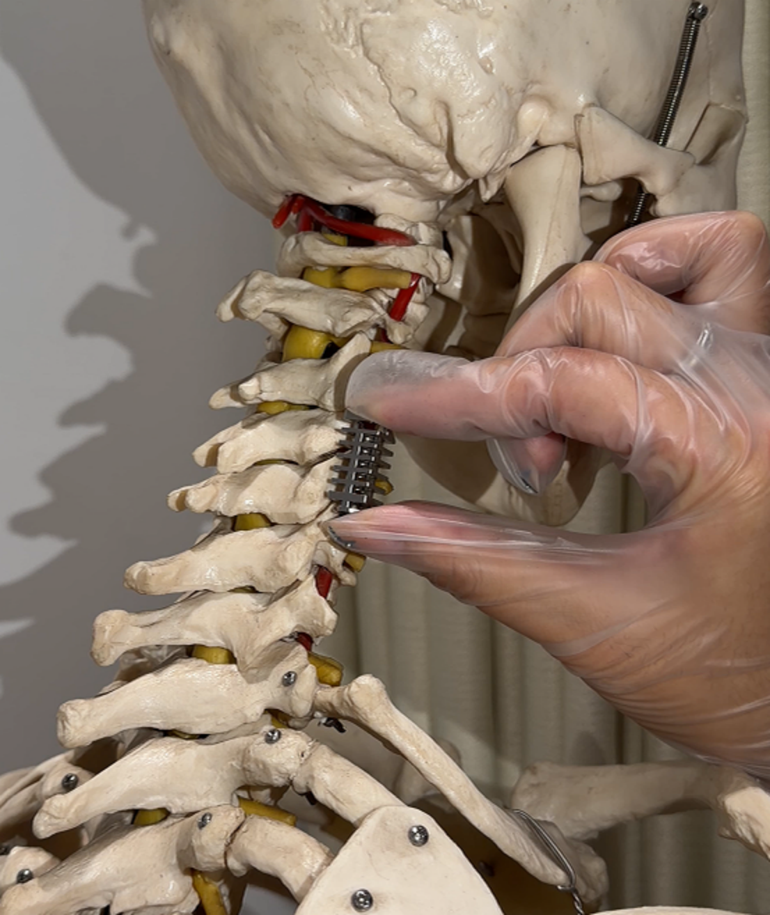 lumbar interbody fusion cage