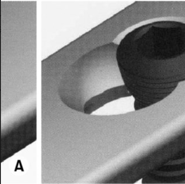 dynamic compression plate