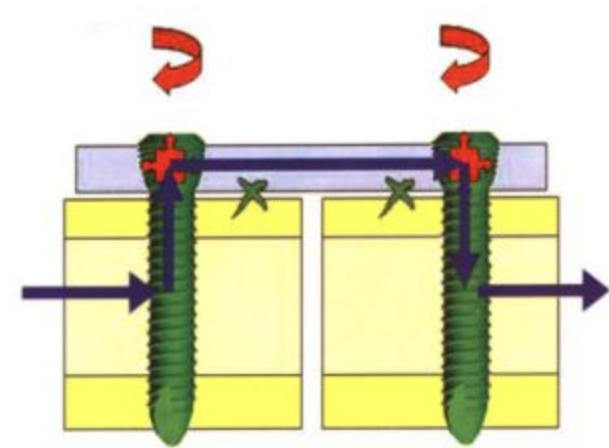 dynamic compression plate