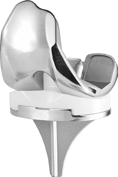 Knee Prosthesis Total Knee Replacement Implant