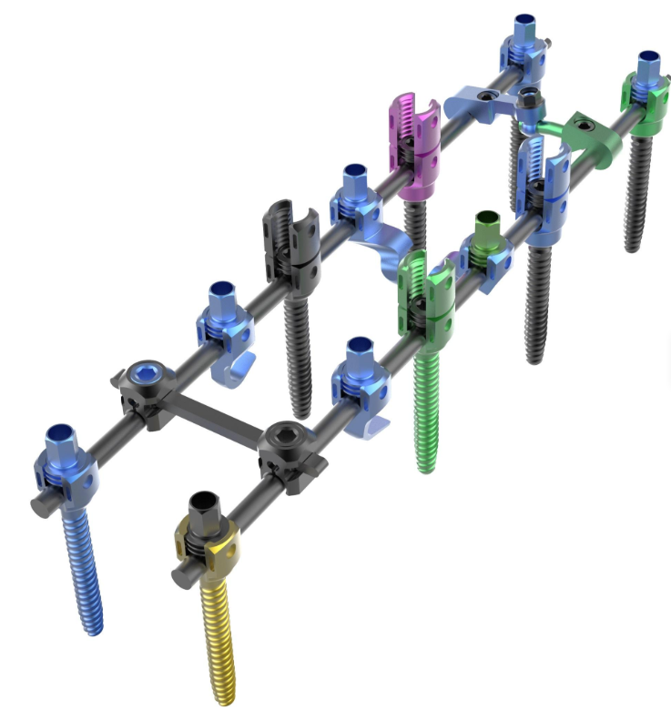 Pedicle Screw & Rod System Spinal Fixation Implant