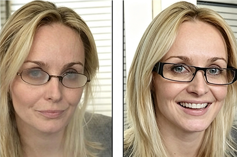 Anti‑Fog Functional Optical Lenses