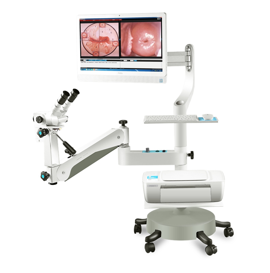 High Resolution HD Photoelectric Integrated Optical Colposcope Equipment KN-2200BII