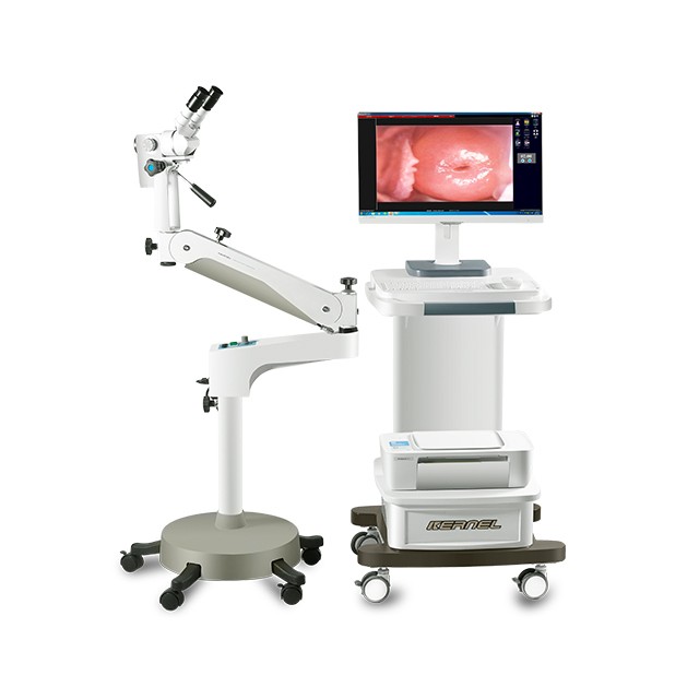 Colposcopio de video óptico para sistema de imágenes de examen ginecológico KN-2200B