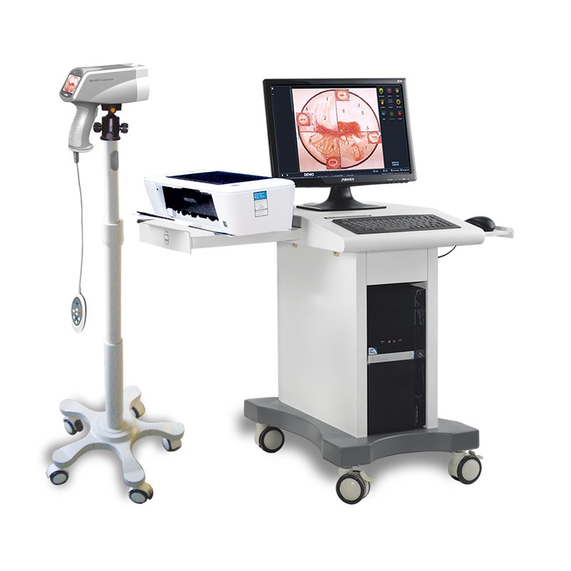 Sistema de imagem digital de colposcópio de vídeo para exame de vagina GN-2200