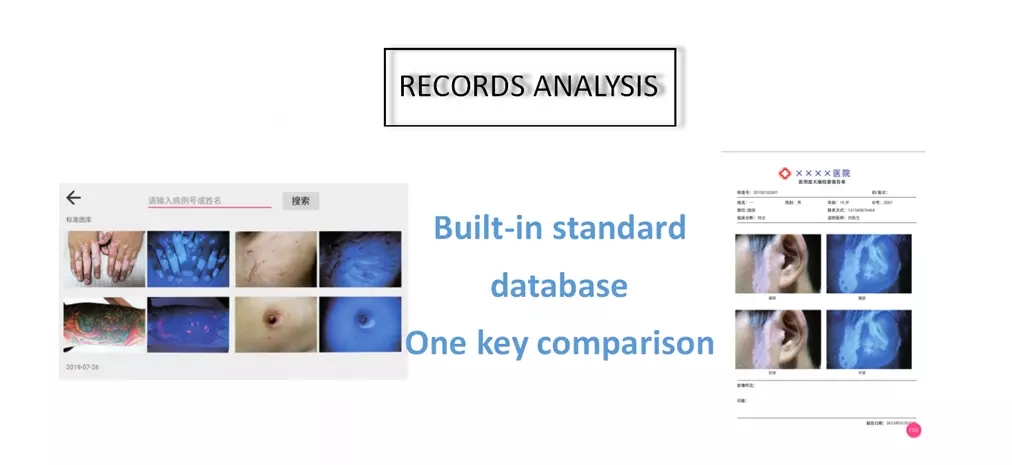 skin analyzer