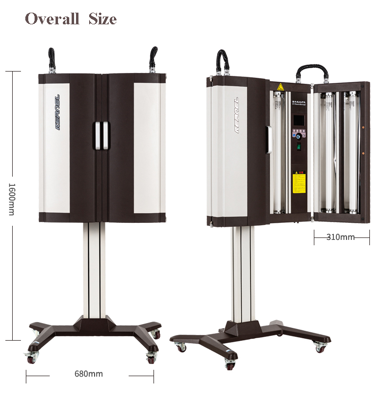 narrowband UVB phototherapy