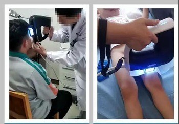 Kernel 308nm Excimer UV fototerapi KN5000 serisinin dikkat çekici tedavi etkisi