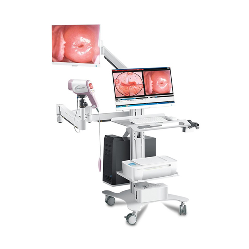 Full HD Gynecological Digital Video Colposcope Equipment KN-2200IH Optional Two Screens