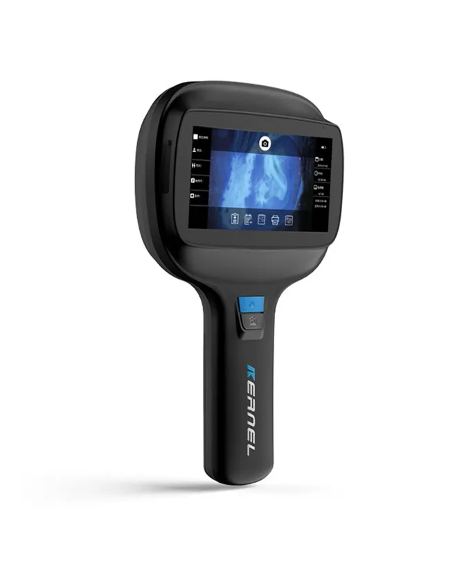 Cilt analiz makinesi ahşap lamba KN-9000A