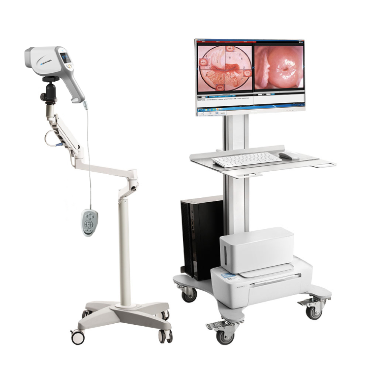 Video Colposcopy Camera Equipment KN-2200A